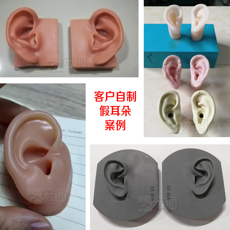 假耳朵硅膠宏圖案例 假耳朵硅膠宏圖案例